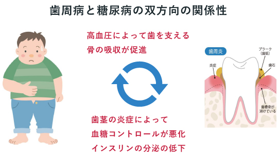 歯周病と糖尿病の双方向の関係性